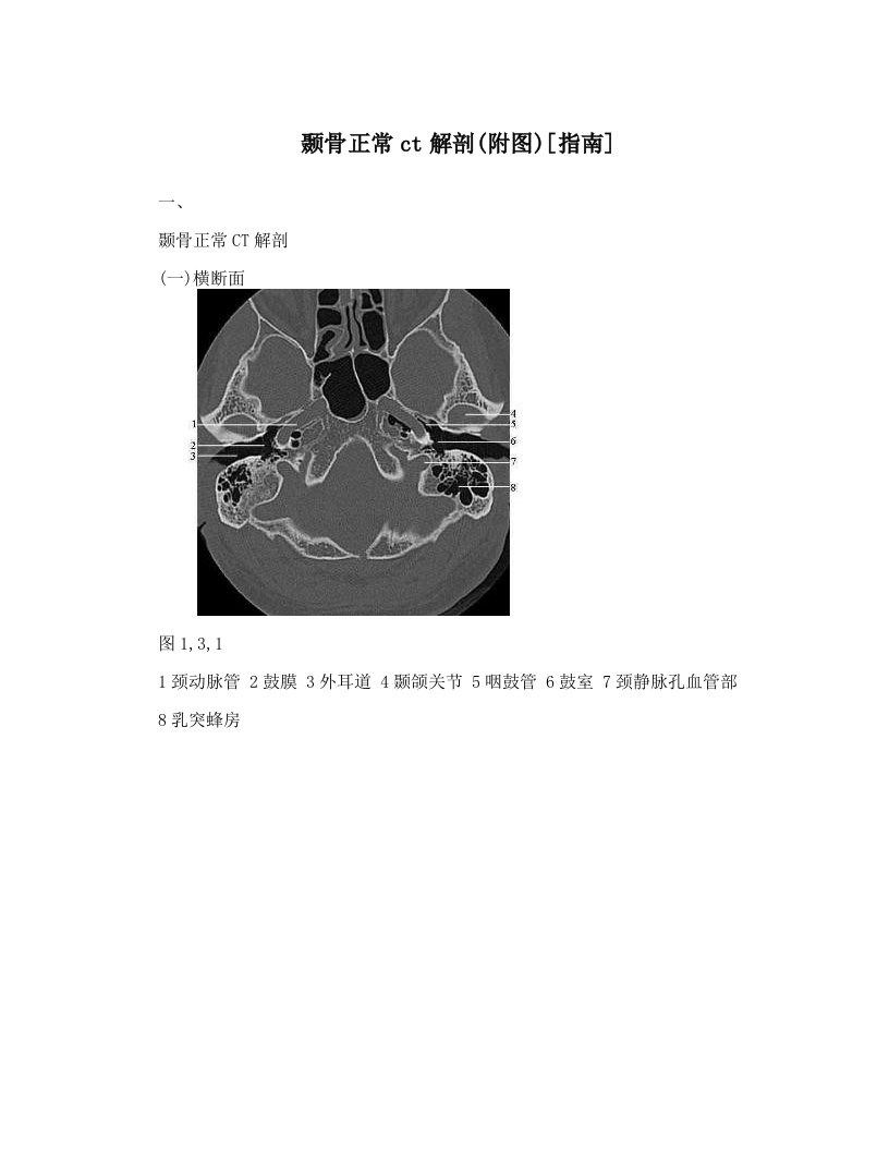 颞骨正常ct解剖&#40;附图&#41;[指南]