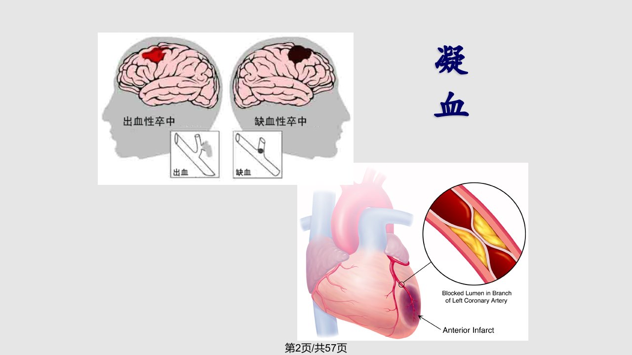 血液系统疾病临床用药