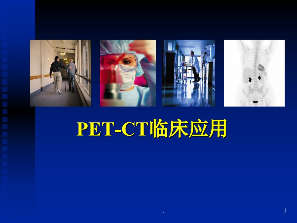 脑部pet的临床应用ppt课件