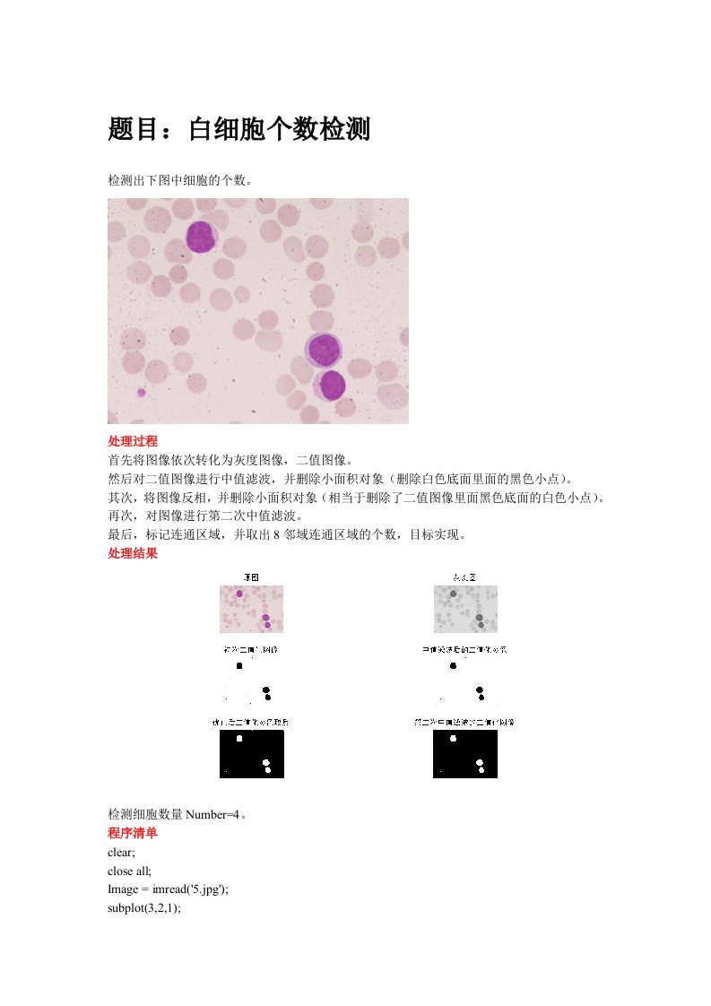 图像处理——细胞个数检测(Matlab)