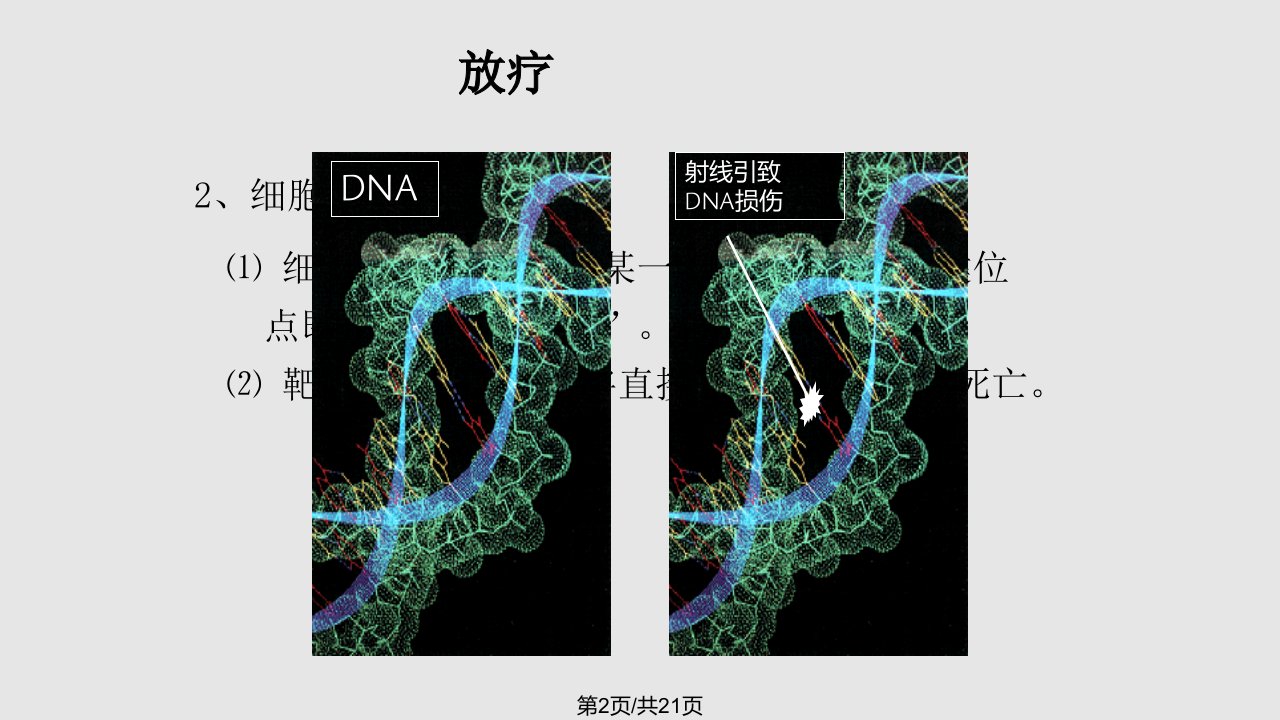 肿瘤放疗患者护理