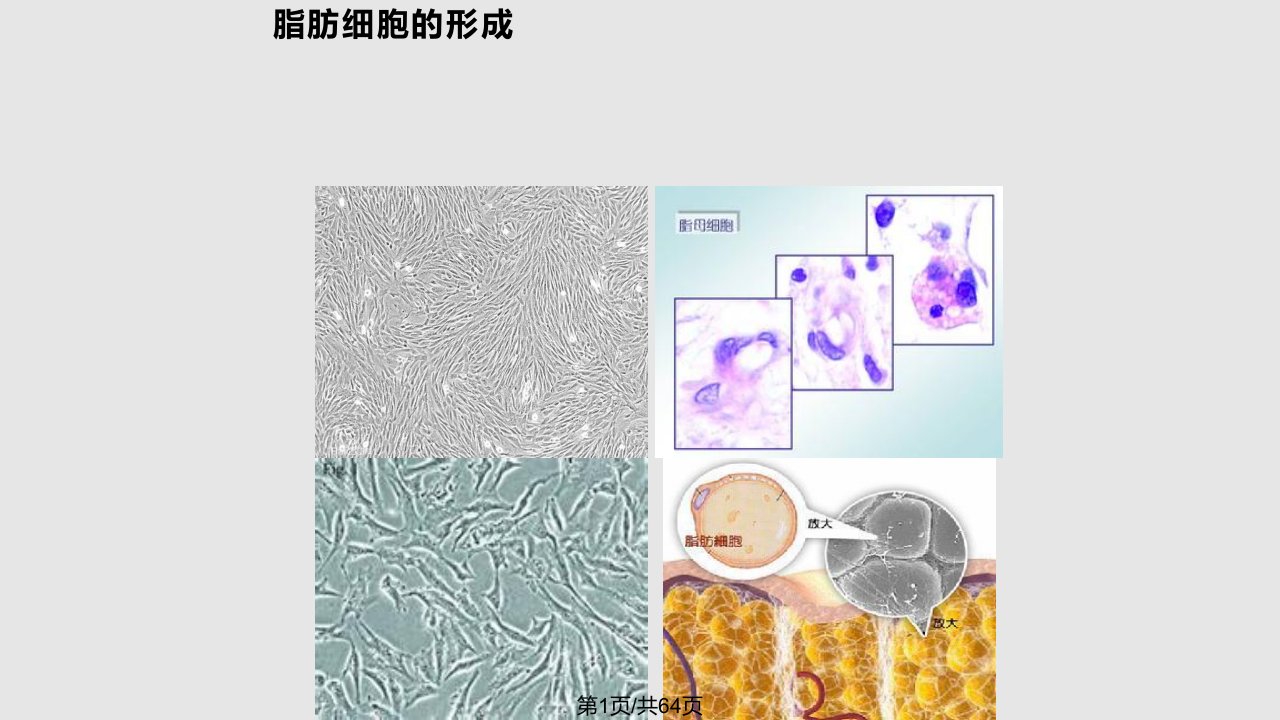 脂肪栓塞综合征PPT课件