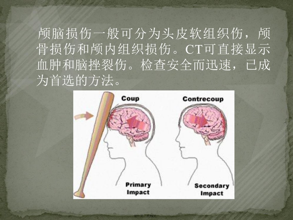 医学影像诊断学颅脑篇