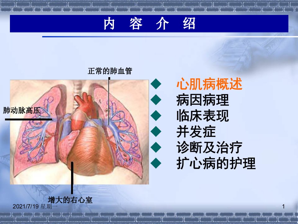 医学专题扩张型心肌病查房