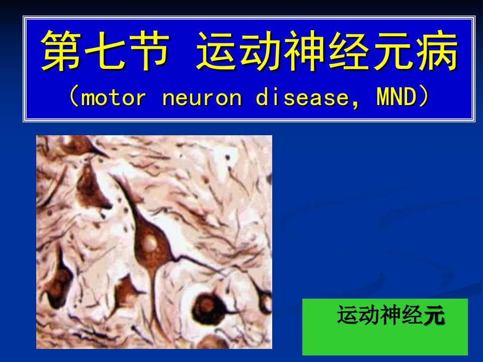 常见疾病病因与治疗方法第8章运动神经元病