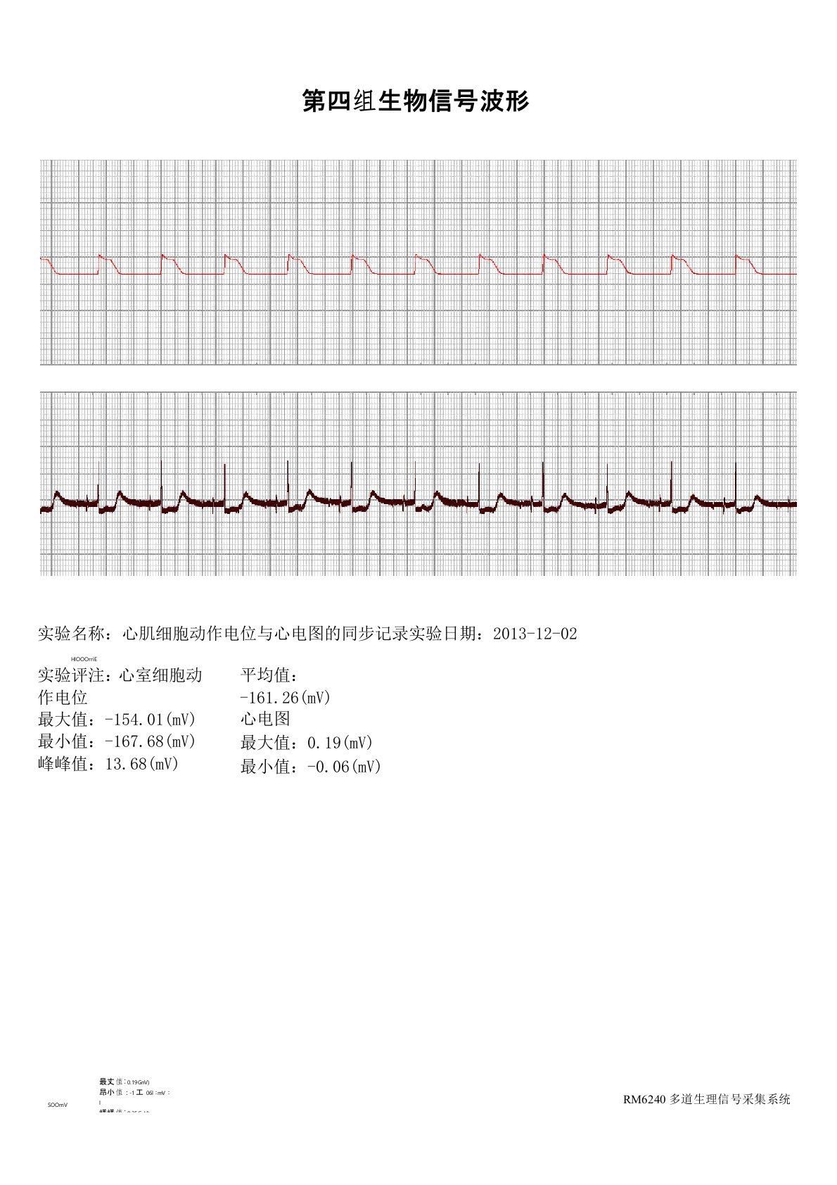 心肌细胞动作电位与心电图的同步记录