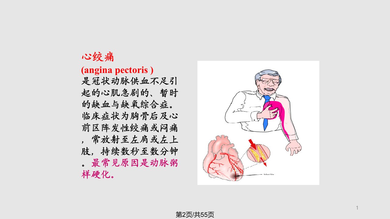 药理学抗心绞痛药