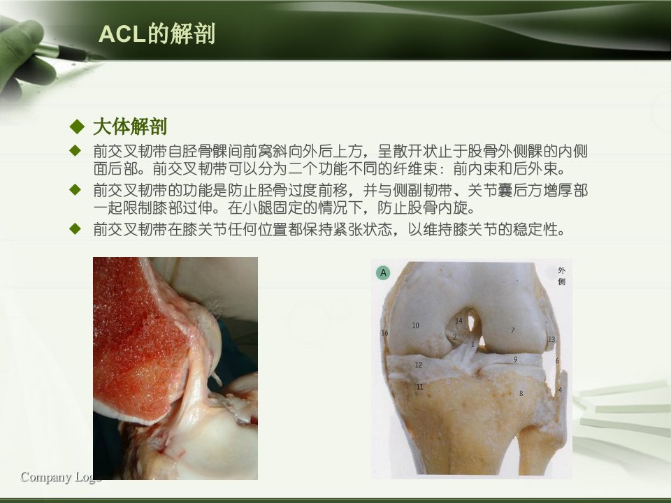 acl损伤影像学诊断