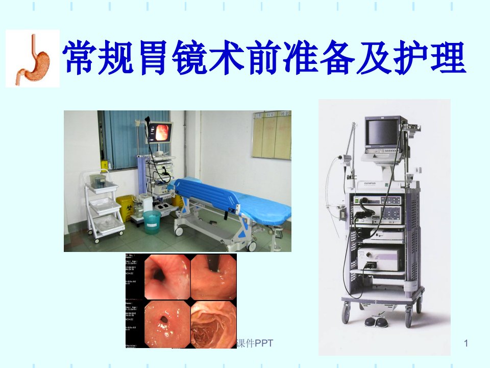 常规胃镜术前准备及护理ppt课件