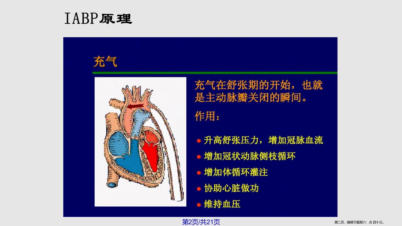 IABP的护理要点学习