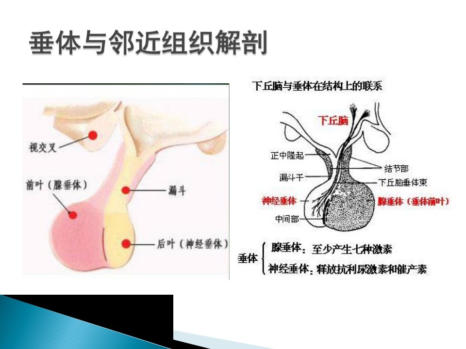 垂体瘤影像诊断ppt课件