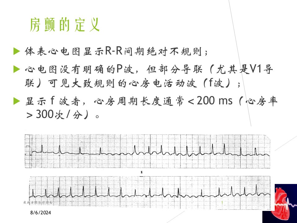 2021年最新房颤治疗指南