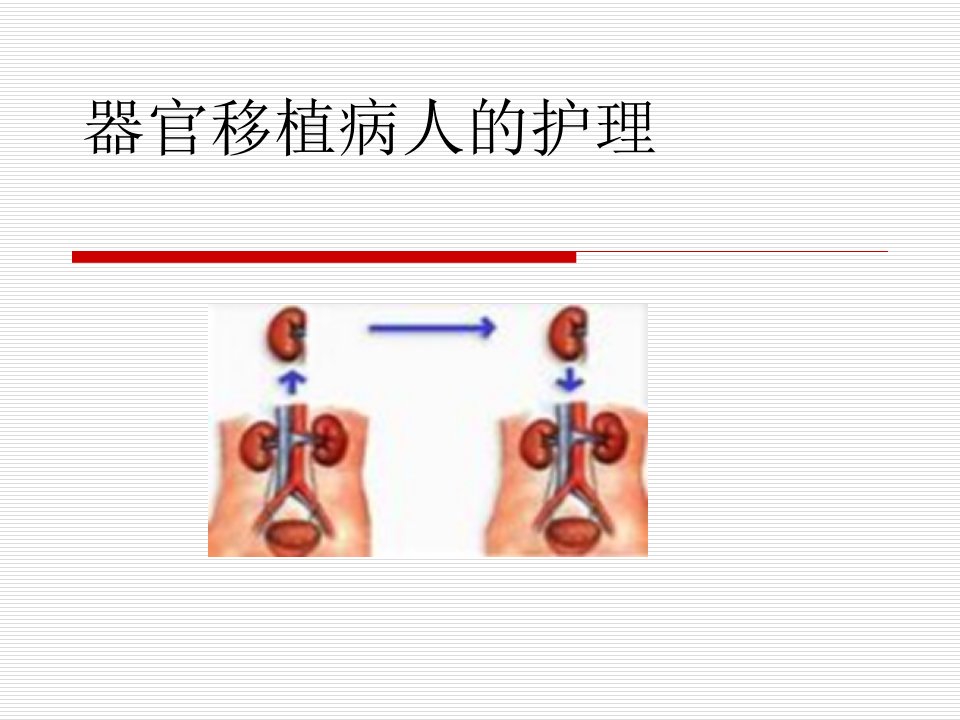 基础医学]器官移植护理