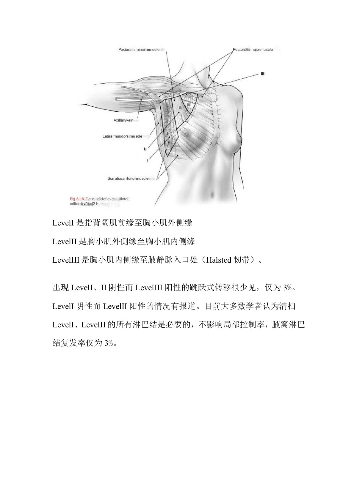 Berg腋窝淋巴结分级标准