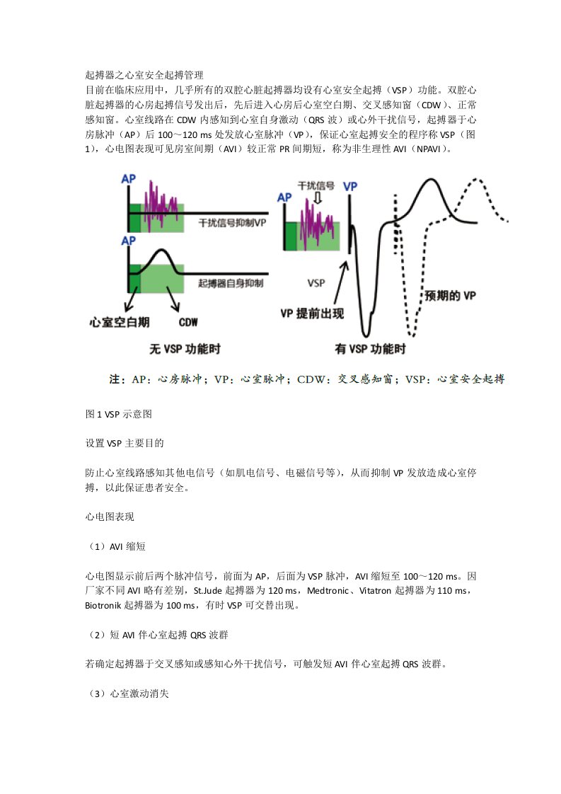 起搏器之心室安全起搏管理