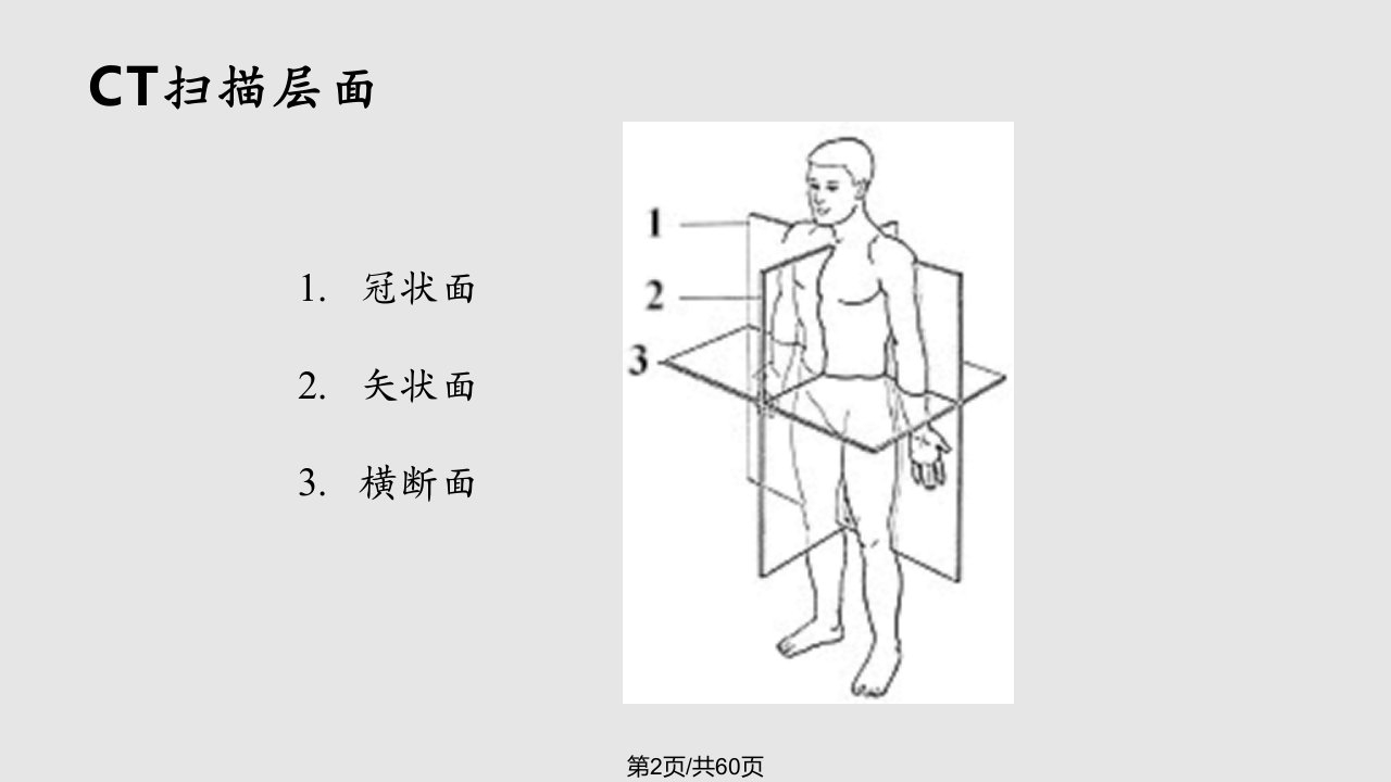 脑部CT讲座学习