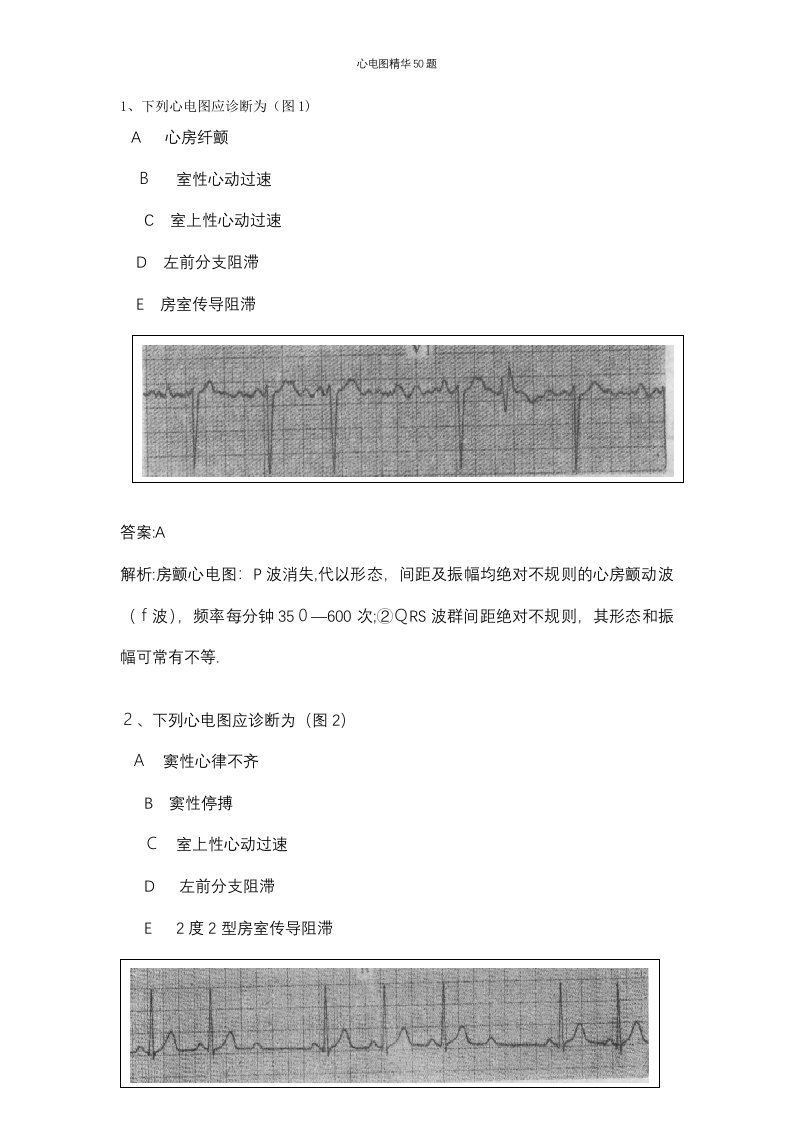 心电图精华50题