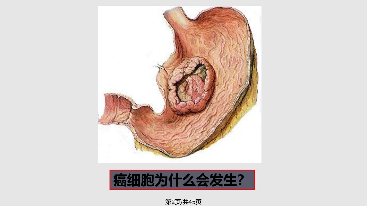 病理生理学细胞凋亡异常与疾病