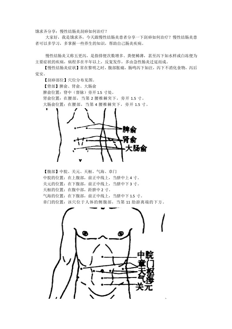 饿求齐分享慢性结肠炎刮痧如何治疗