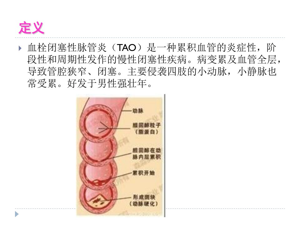 血栓闭塞性脉管炎护理讲义