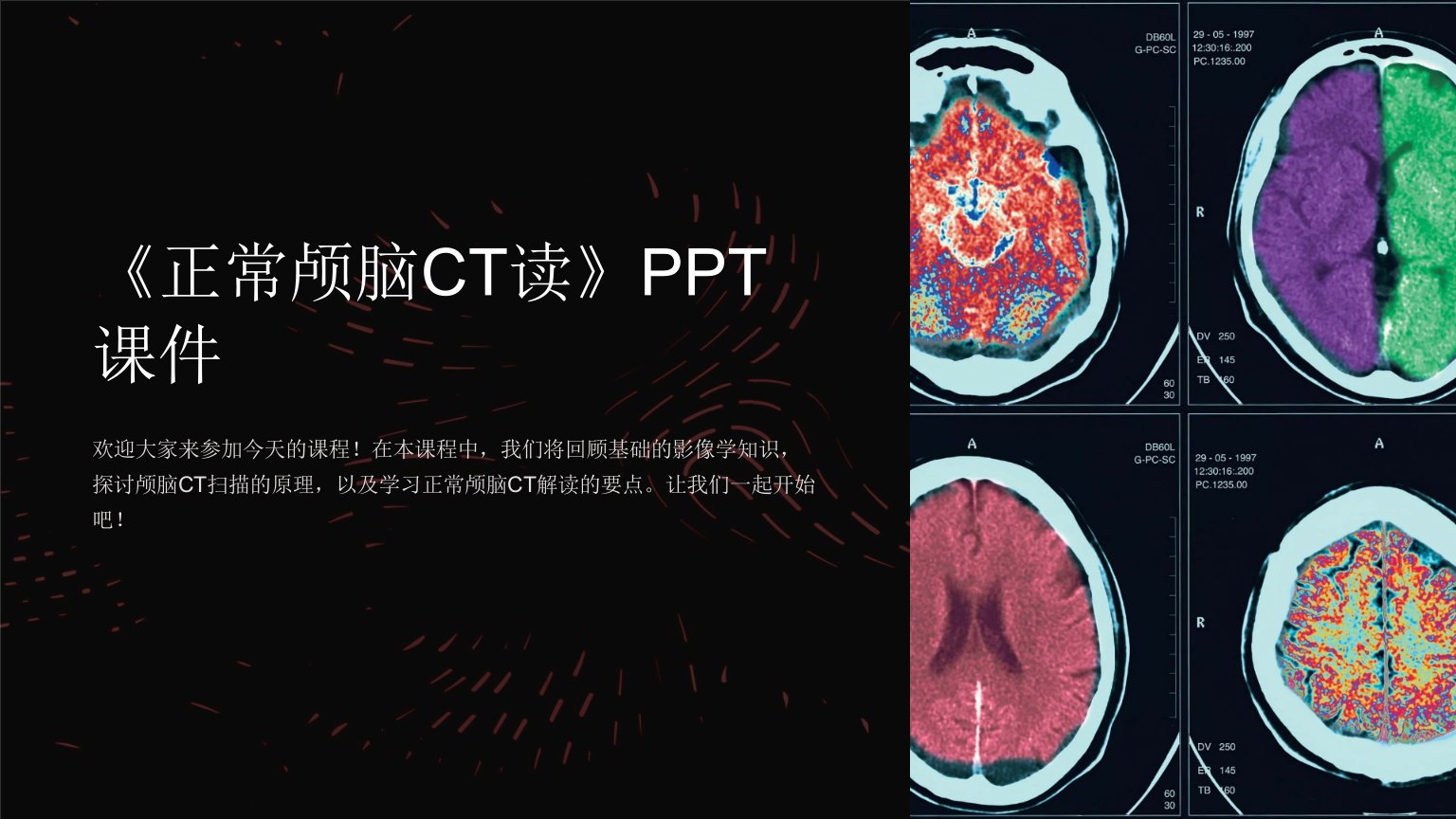 《正常颅脑CT读》课件