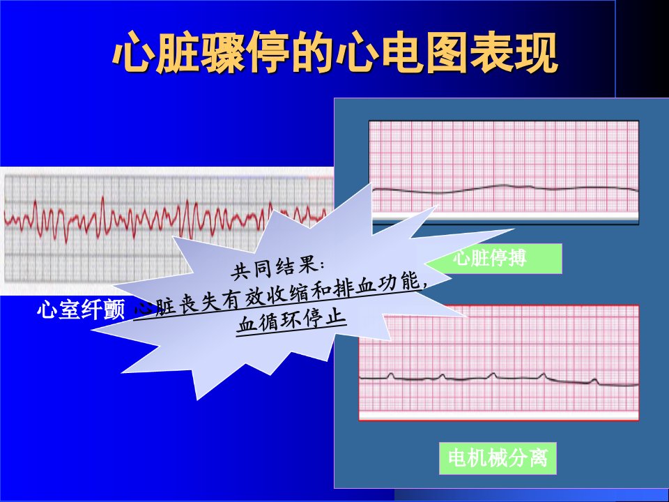 最新心肺复苏副本ppt课件