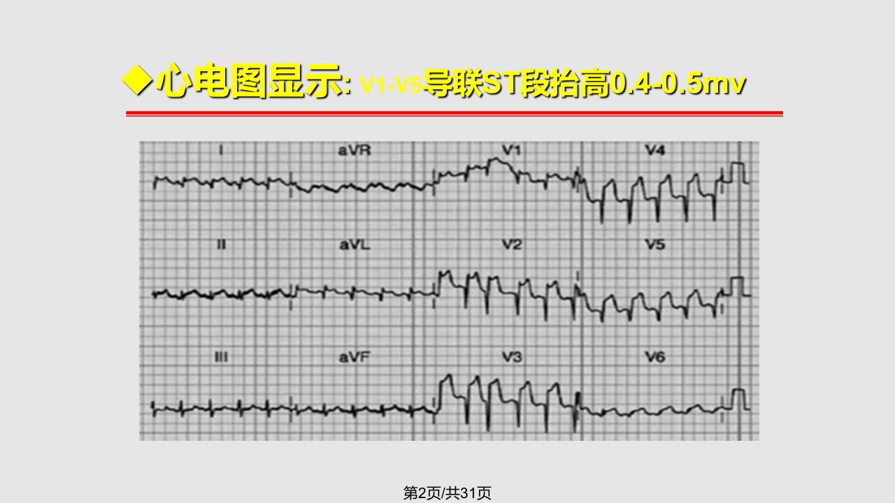 受体阻滞剂临床应用病例分析