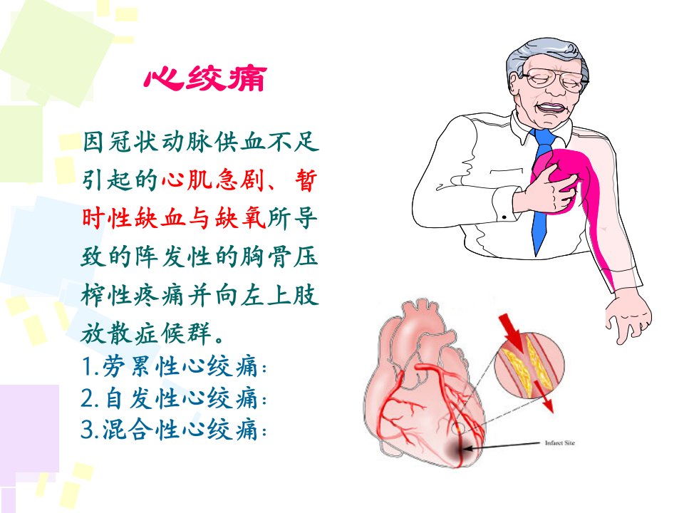 抗心绞痛药AntianginalDrugs