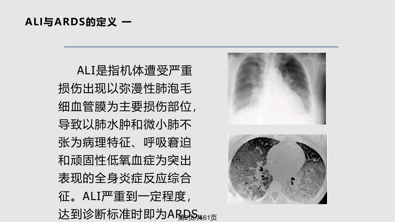 ARDS的概念学习教程