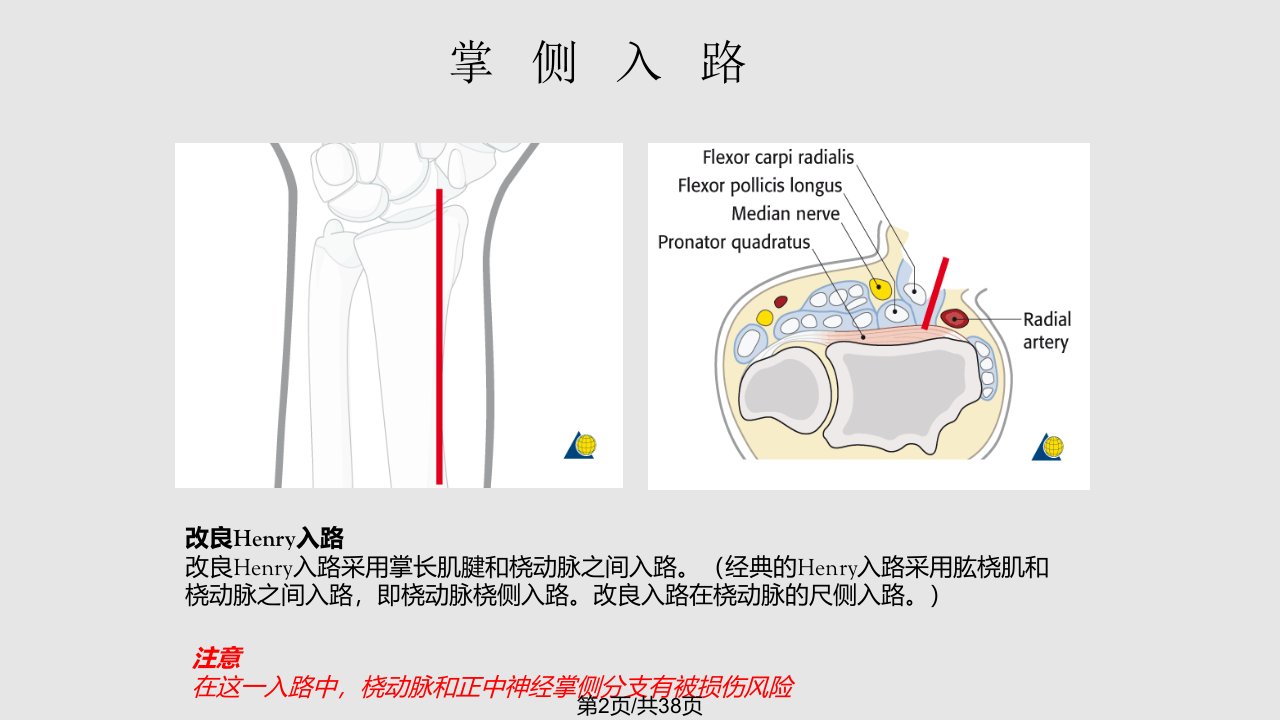 桡骨远端骨折