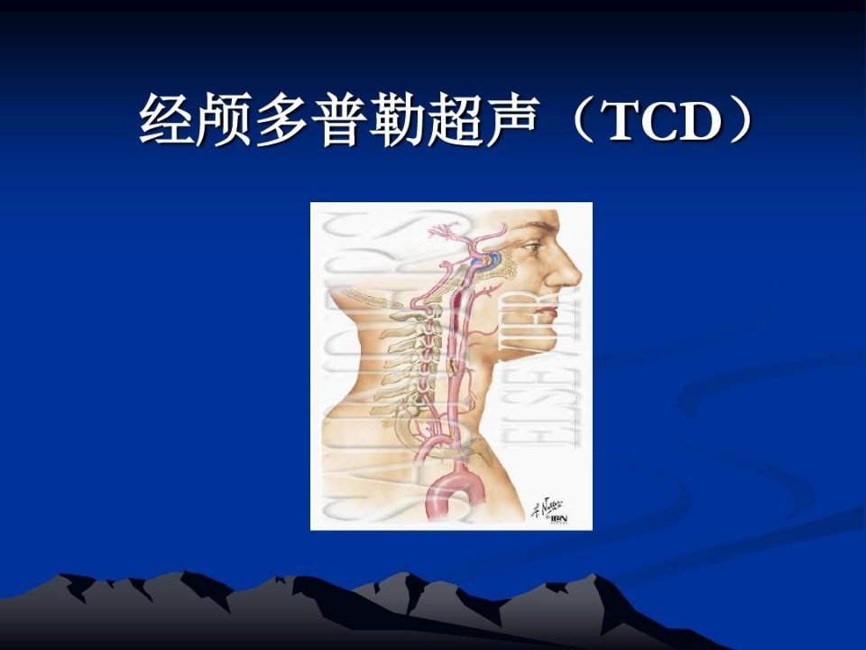 经颅多普勒(TCD)讲解