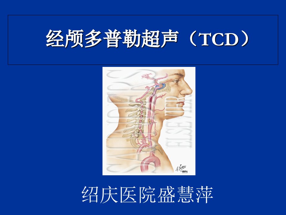 经颅多普勒(TCD)讲解