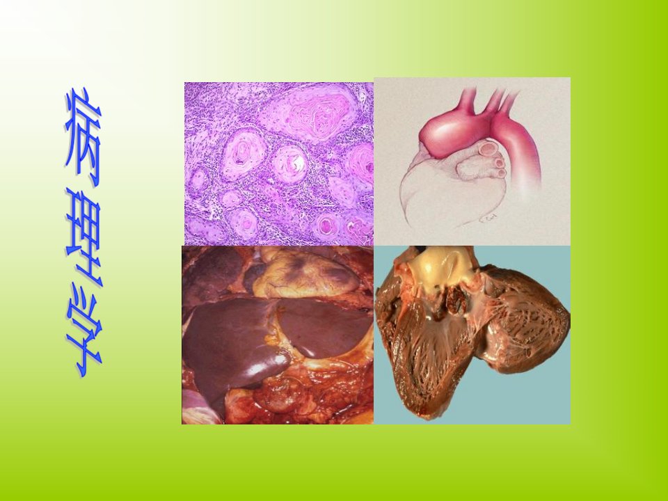 病理学第一章绪论ppt课件