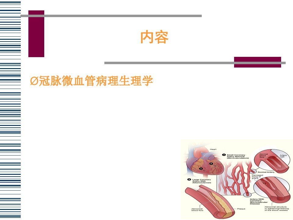 冠状动脉微血管病变及对策