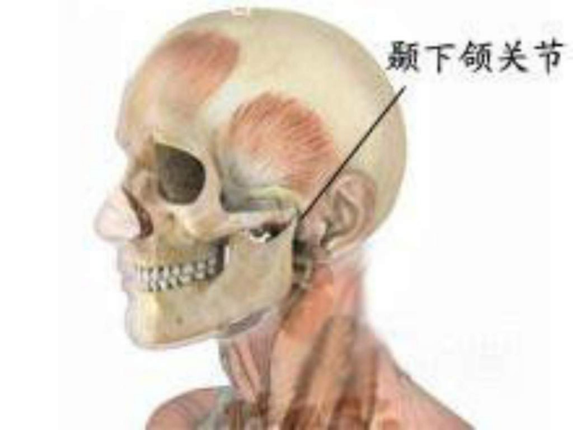 《颞下颌关节常见病》PPT课件