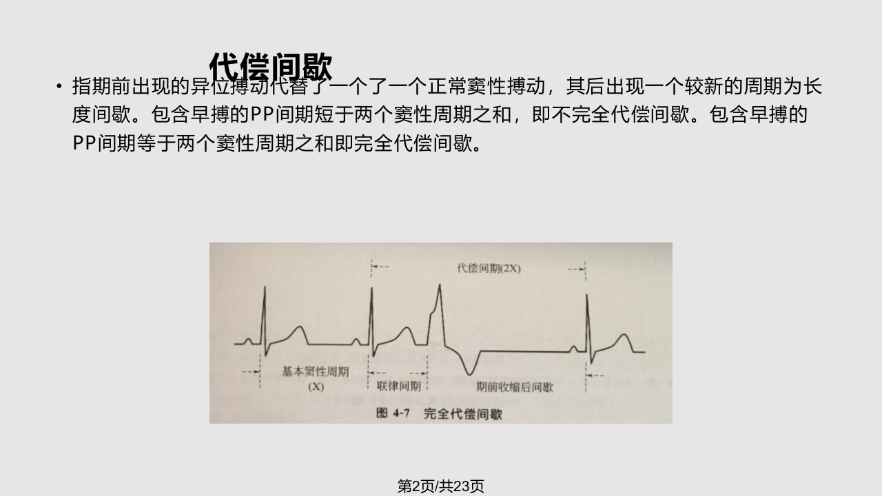 期前收缩学习