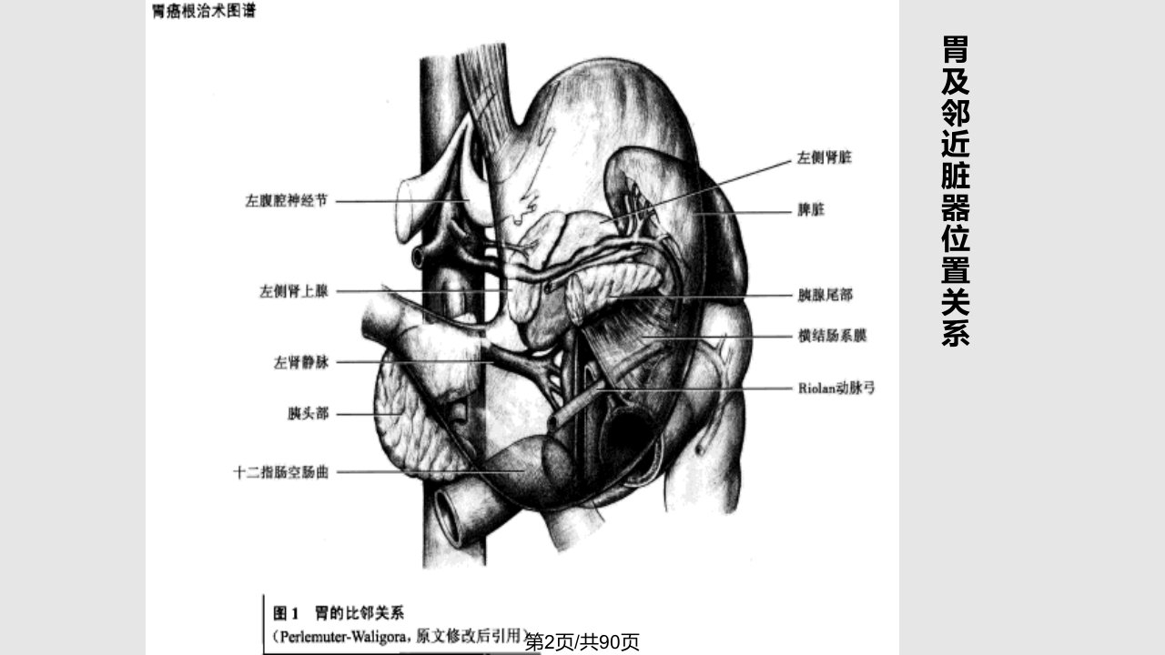 胃癌根治术学习