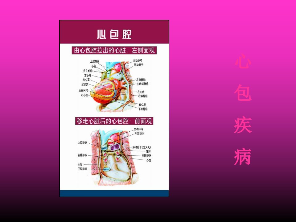 心包疾病专题知识宣教-PPT医学课件