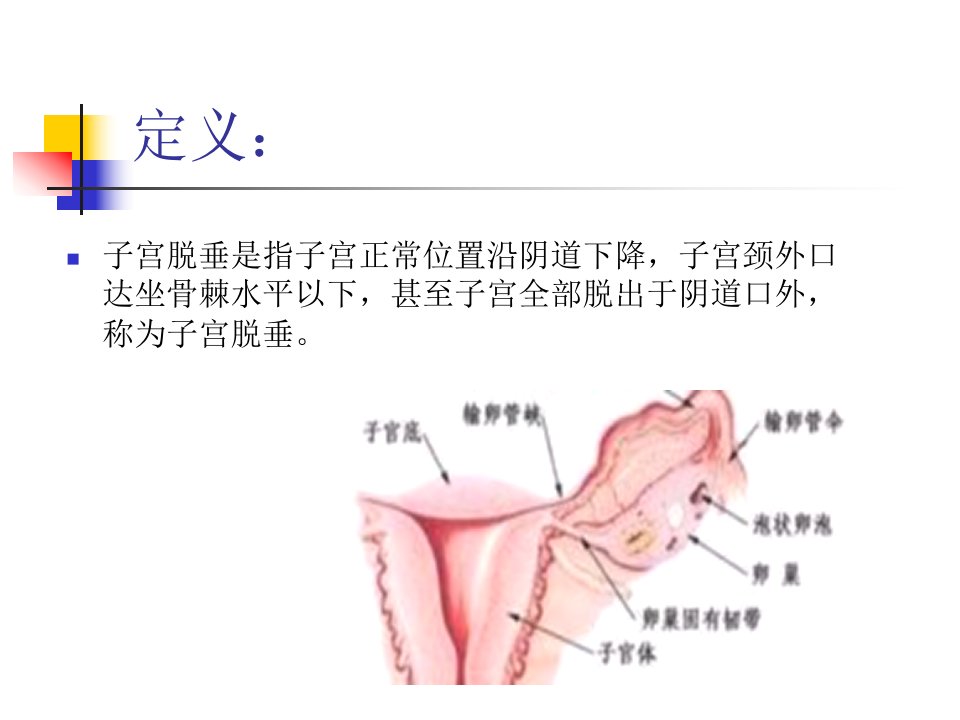 PPT子宫脱垂