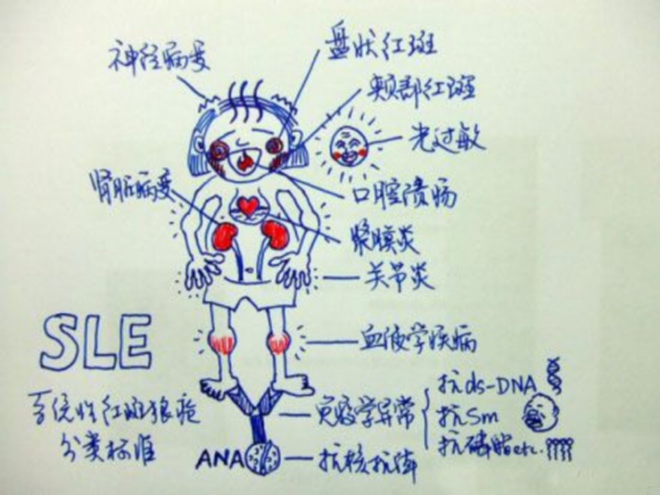 内科护理学系统性红斑狼疮的护理ppt课件