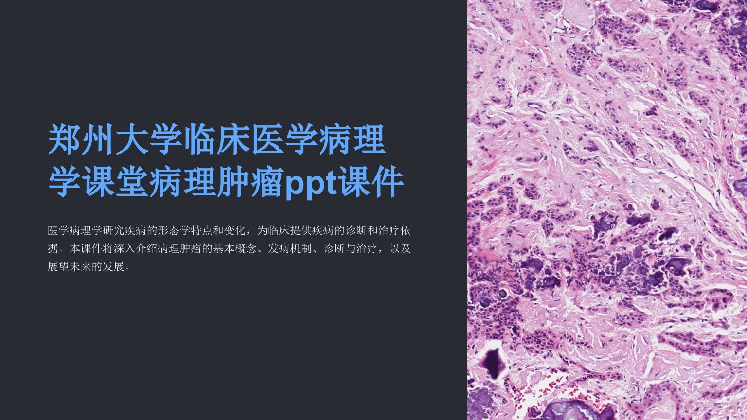 郑州大学临床医学病理学课堂病理肿瘤课件