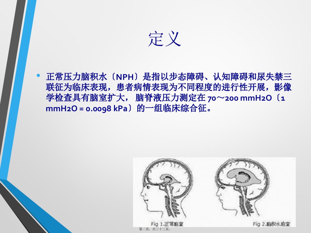 中国特发性正常压力脑积水诊治专家共识