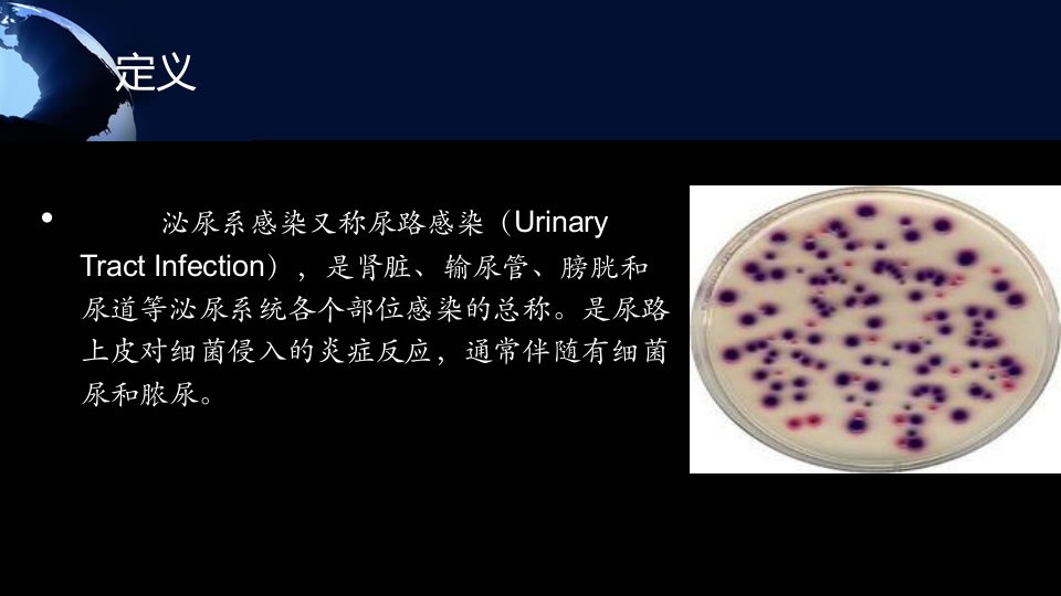 医学专题单纯性尿路感染