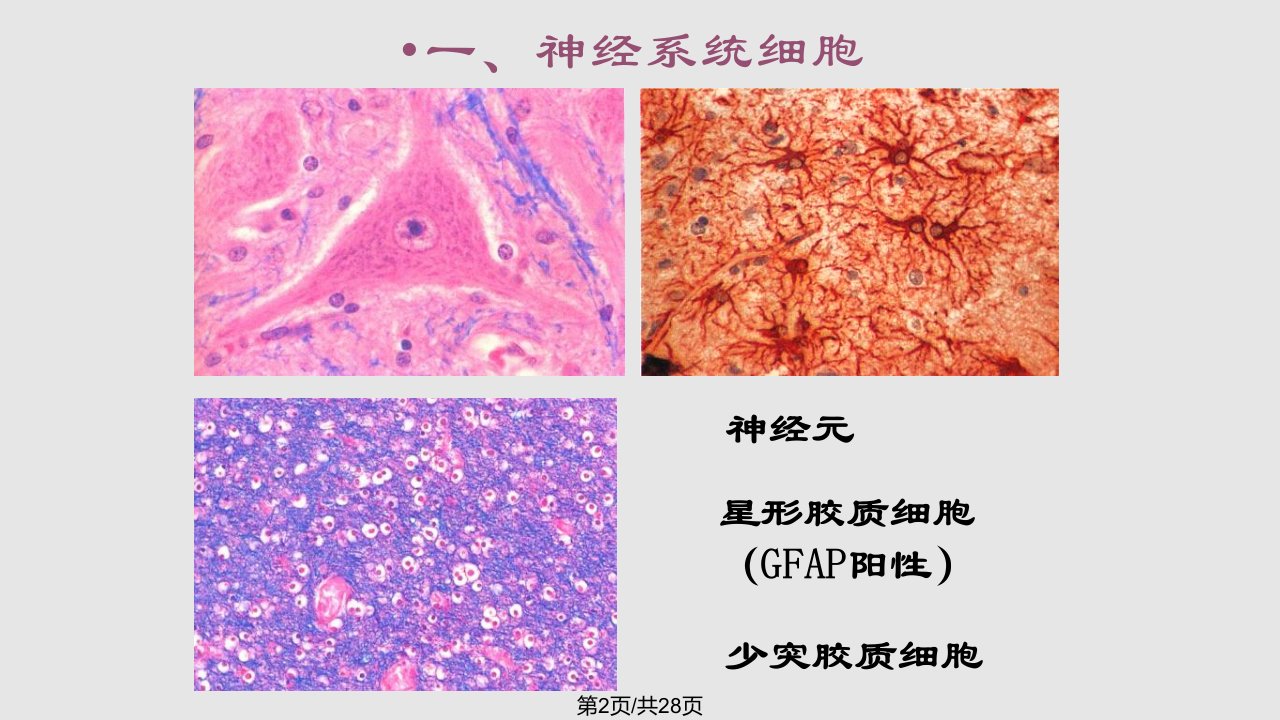 神经系统疾病3