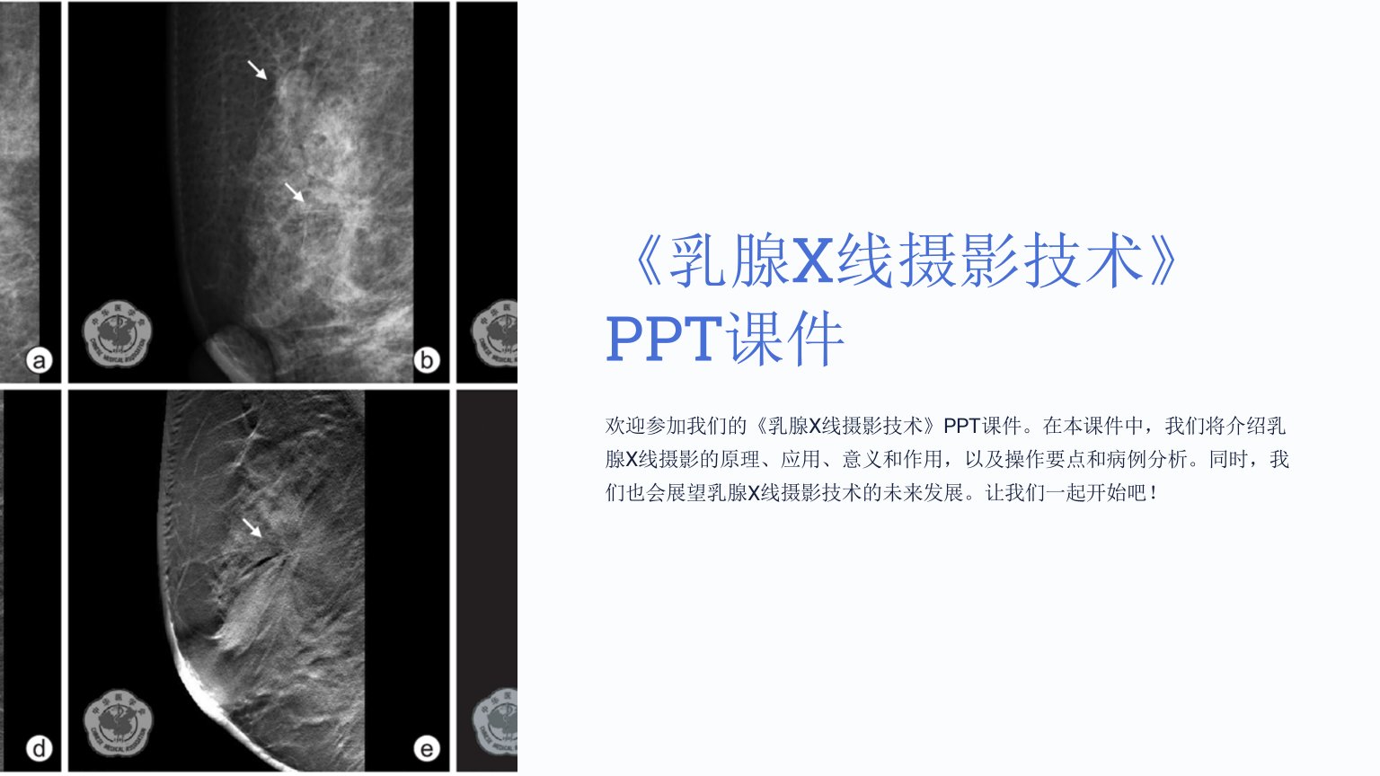 《乳腺X线摄影技术》课件