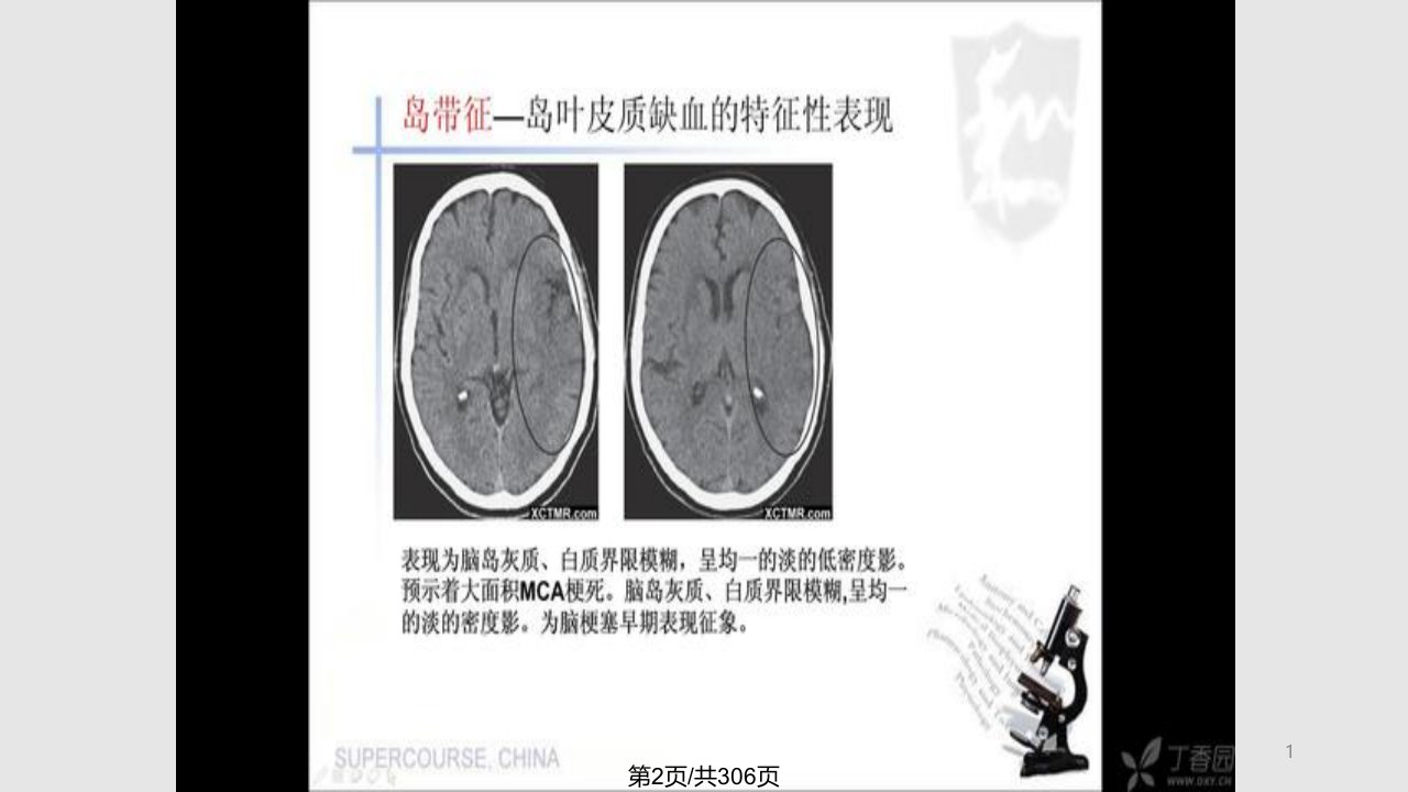 神经内科影像