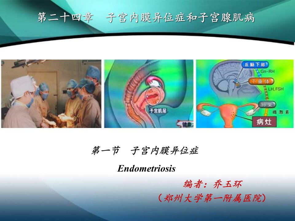 医学课件子宫内膜异位症和子宫腺肌病