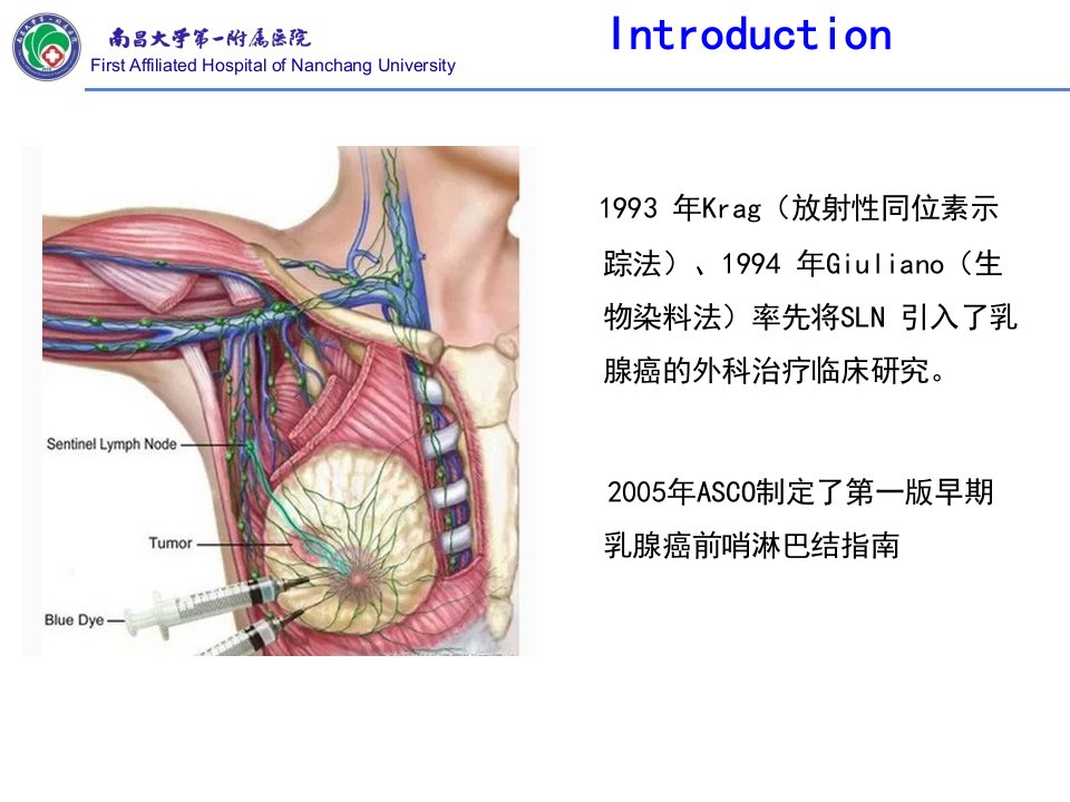 乳腺癌前哨淋巴结处理现状ppt课件