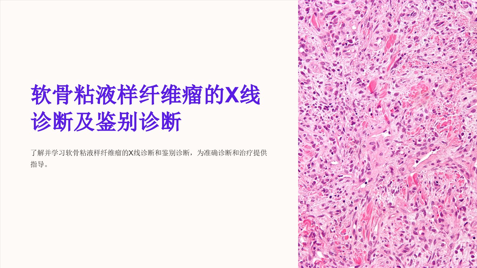 软骨粘液样纤维瘤的x线诊断及鉴别诊断课件