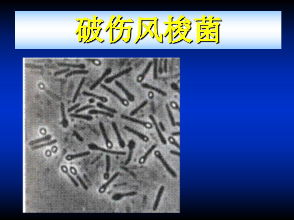 破伤风梭菌资料